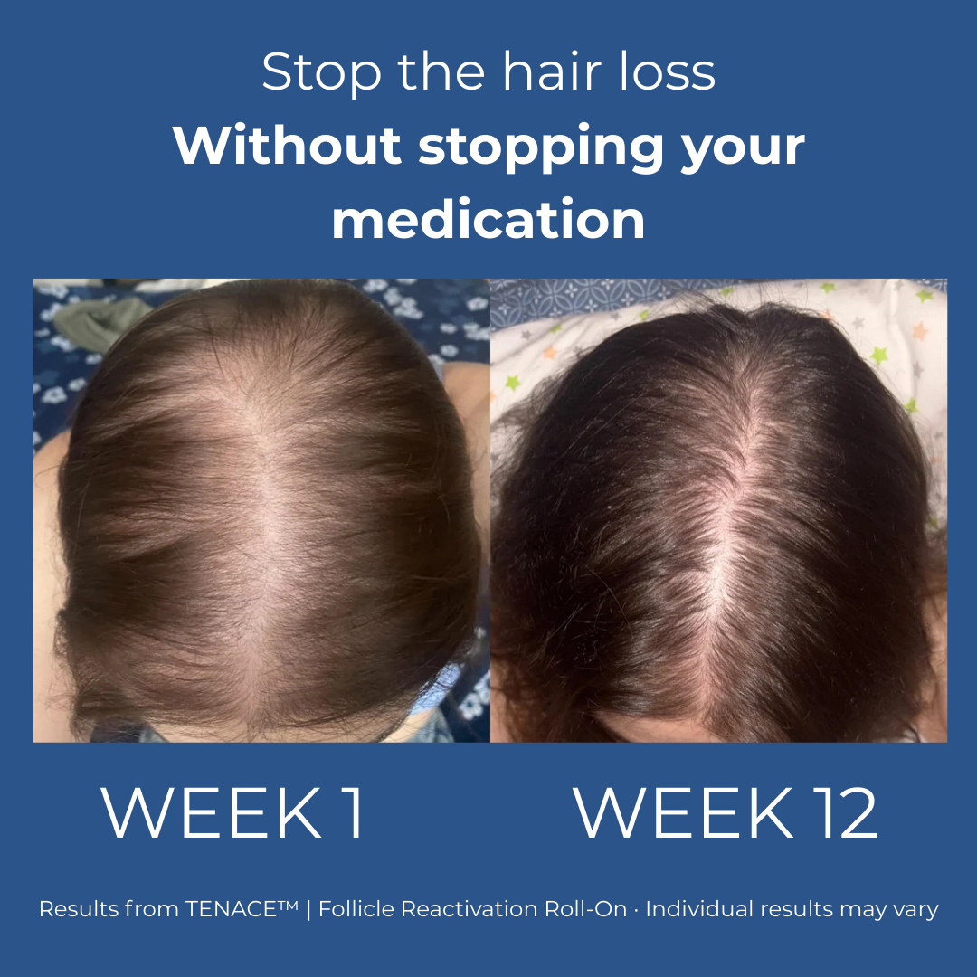 Tenace Follicle Reactivation Roll-On