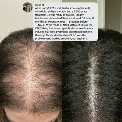Tenace Follicle Reactivation Roll-On