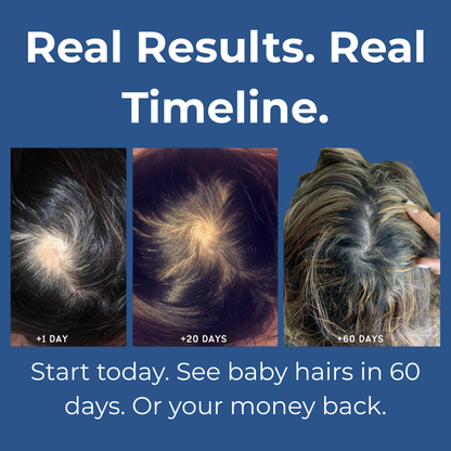 Tenace Follicle Reactivation Roll-On
